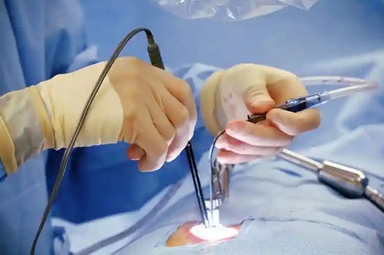 Minimal Invasive Heart Surgery